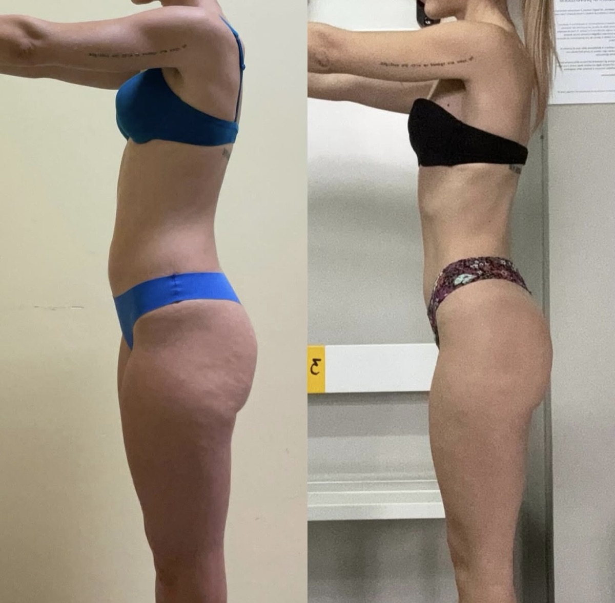 Prima e dopo